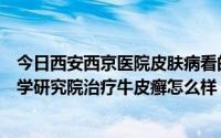 今日西安西京医院皮肤病看的好的专家（西安京科皮肤病医学研究院治疗牛皮癣怎么样）